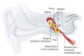 Image result for Tympanometry