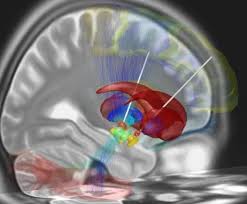 Image result for arte xeplion
