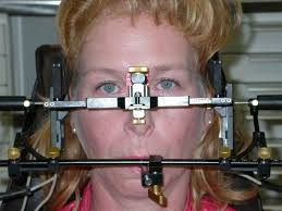 Zahnarzt Dr.Bieker Göttingen Zahnimplantat Kosten Zahnimplantate Veneers  Implantat Implantate Bleaching Ästhetik