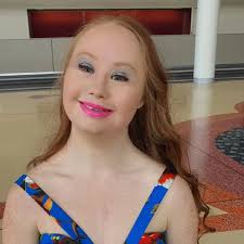 Madeline Stuart