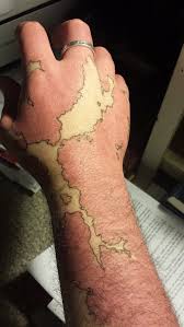 Birthmark On Leg Meaning This Guy Is Transforming His Birthmark Into A Map Of An Imaginary World Birthmark Tattoo Creative Tattoos Cool Tattoos