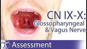 We're going to be talking a lot about this amazing mechanism today so just in case you don't know her, the vagus is the longest nerve in the human body. Cranial Nerve 9 10 Glossopharyngeal Vagus Nerve Assessment For Physiotherapists Youtube