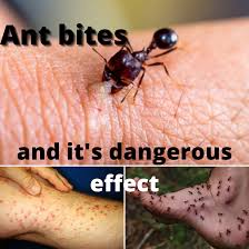 Image result for ant bite