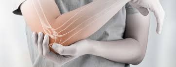 This may occur anywhere along the spine, but is most common in the lower back (lumbar spine). Olecranon Fracture Elbow Fracture Johns Hopkins Medicine