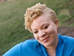 People Of Color With Albinism Ask: Where Do I Belong?