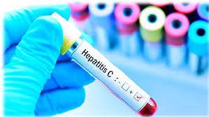 Hepatitis C - info-farmacia