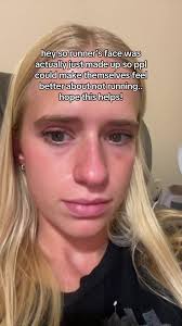 What Is Runners Face Connor Mantz