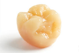 Image result for Tonsillolith