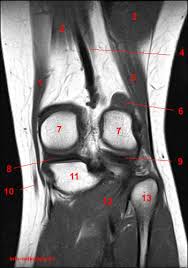This section of the website will explain large and minute details of sagittal knee use the mouse scroll wheel to move the images up and down alternatively use the tiny arrows (>>) on both side of the image to move the images. Atlas Of Knee Mri Anatomy W Radiology