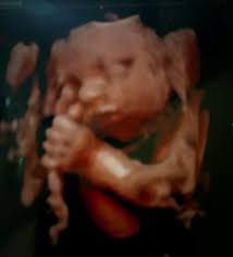 3D ultrasound and chubby babies! Post pics here