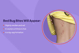 Image result for bedbugs bites