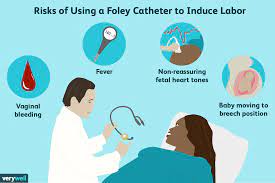 What Is A Foley Bulb Induction