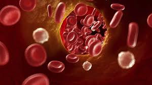 Thrombose Starker Muskelkater Kann Auf Eine Thrombose Hindeuten