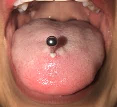 Apr 09, 2009 · the piercing itself on a tongue is the least painful piercing i have ever gotten but the healing of this piercing was the most painful. Still Paranoid My Tongue Piercing Might Get Infected Tomorrow Marks A Week Since I Got It Done I Ve Been Washing With Mouthwash Doesn T Hurt Feels A Little Itchy Here And There Swelling