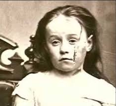 Deer reduction program controversy in Ohio