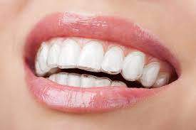 They move teeth and the roots of teeth over weeks and months of treatment. How Does Invisalign Work
