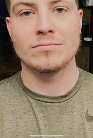 This is NOT Solving Hair Loss Issues...