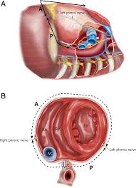 A small amount of fluid keeps the layers separate so there's less friction between them as the heart beats. Long Term Results Of Radical Pericardiectomy For Constrictive Pericarditis In Korean Population Journal Of Cardiothoracic Surgery Full Text