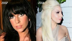 Lady Gaga Nose Job Plastic Surgery Photos Before And After Rhinoplasty Nose Job Lady Gaga Nose Plastic Surgery Photos Lady Gaga Plastic Surgery