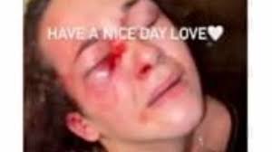 Video of beatdown of local teen goes viral; girl, 17, arrested