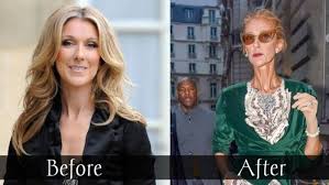 Maybe you would like to learn more about one of these? Updated Celine Dion Weight Loss Health Eating Before After 2021