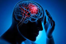 Ependymomas are a type of childhood brain tumor that can be benign (noncancerous) or malignant (cancerous). What Were Your First Signs And Symptoms Of A Brain Tumor