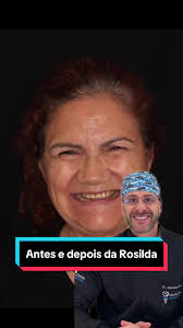 Antes e depois da nossa paciente Rosilda!😁🙏🏻 #allon4 #odonto #fy  #dentista #implantes #fyp #viral #implantesdentarios