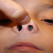 Air yang terlalu sedikit mengurangi proses fotosintesis sehingga tanaman kekurangan makanan dan layu. Nasal Sinus Cure Rawatan Resdung Kesan Seawal 5 Minit Facebook