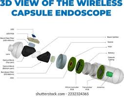 Image result for Wireless Capsule Endoscopy