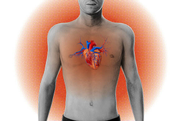 Temperature: What does heat do to the body – and how does it kill?