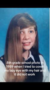 School Photo Trying to over Lazy Eye