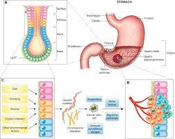 Stomach cancer begins when cancer cells form in the inner lining of your stomach. Helicobacter Pylori Infection And Gastric Cancer Biology Tempering A Double Edged Sword Springerlink