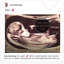 A Baby Girl Congratulations Monniexiong Nubtheory 12weekspregnant Babygender Itsagir In 2020 Ultrasound Gender Ultrasound Boy Or Girl 12 Week Ultrasound