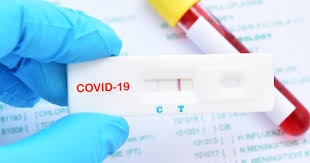 Selon le ministère de la santé. Depistage De La Covid 19 Les Tests Antigeniques Federation Francaise Des Diabetiques