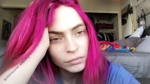 What Happened to Skylar Davies, Billie Eilish's Most Devoted Fan?