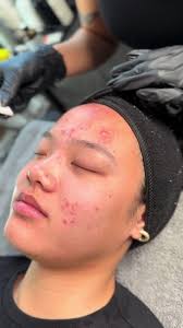 Aeterna Aesthetics West Chester