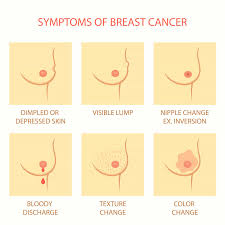 Breast cancer that has spread can cause swelling in lymph nodes under the arms. Cancer Symptoms Pictures 5 Early Warning Signs Of Breast Cancer Most Women Ignore Head And Neck