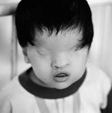 (victims of dioxin in vietnam). Opinion America Please Don T Forget The Victims Of Agent Orange The New York Times