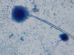 Aspergillus was first catalogued in 1729 by the italian priest and biologist pier antonio micheli. Aspergillus Flavus
