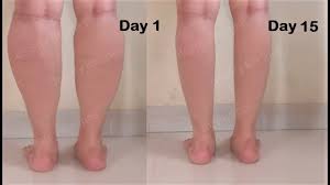 How can i lose weight on my legs? How I Got Slim Calves Legs In 1 Week Easy Leg Exercise Workout To Get Slim Legs Lose Leg Fat Youtube