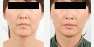 Kenneth K. Kim, MD, Board Certified Plastic Surgeon