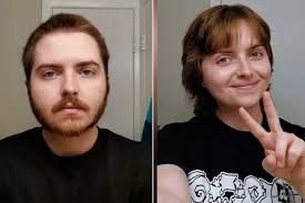 I found purple spots