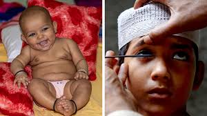 True Colors: Unmasking Hidden Lead in Cosmetics from Low- and Middle-Income  Countries