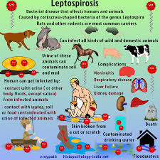 Pathology Of Leptospirosis Bacterial Diseases Medical Posters Respiratory Diseases