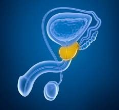 Prostatakrebs Ursachen Diagnose Behandlung Reha