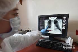 Intervyu S Gomelskim Rentgenologom Pnevmoniya Pri Covid 19 Pohozha Na Pnevmoniyu Pri Svinom Grippe