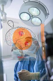 The causes of coma with ketoacidosis: What Is The Prognosis Of Glioblastoma With Pictures