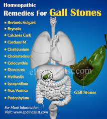 Homeopathic Remedies For Gall Stones Cholelithiasis