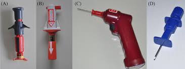 Image result for Intraosseous Access