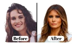 She's fabulous. I look rounded face when young and now I hand chic bones  and all. Never did anything. She's stunning to me at 56.